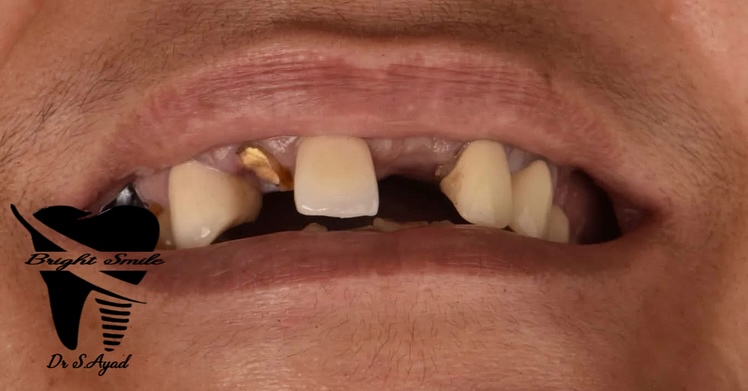 Nouveau sourire, nouvelle vie - Transformation 3